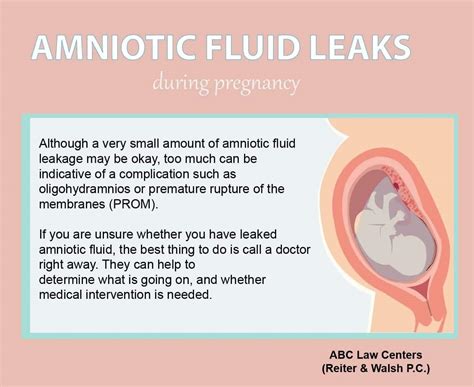 treatment for leaking amniotic fluid|Leaking Amniotic Fluid 